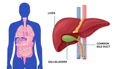 Gallbladder Removal Surgery in Gandhinagar